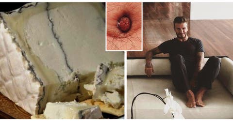 Fabrican «queso apestoso» con bacterias sacadas de los pies, axilas y ombligo de famosos