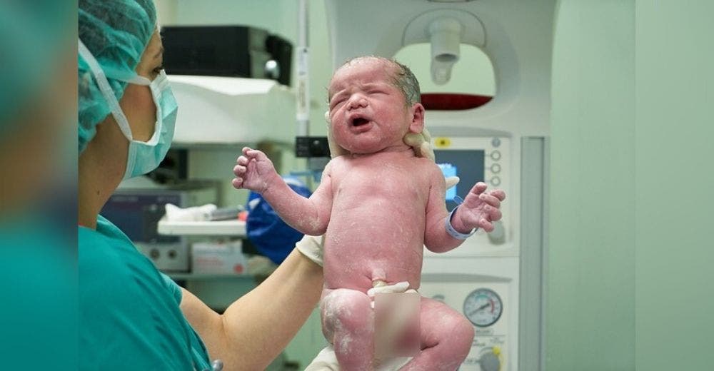 Nace Sin órgano Reproductor Un Caso Que Ocurre En Uno De Cada 30 Millones De Nacimientos 5959